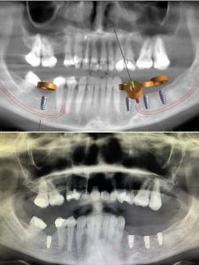 P7D Clinical Case, Djalev Dental Clinic